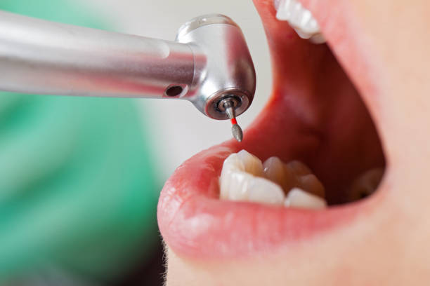 Best Emergency Dental Care for Sports Injuries in Ladera Heights, CA